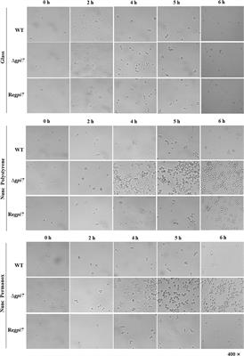 Deficiency of GPI Glycan Modification by Ethanolamine Phosphate Results in Increased Adhesion and <mark class="highlighted">Immune Resistance</mark> of Aspergillus fumigatus